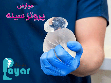 در مورد عوارض پروتز سينه چه میدانید؟