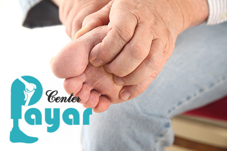 انواع خارش کف پا کدامند؟
