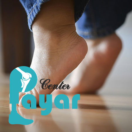 علت کوتاهی تاندون آشیل در کودکان چیست؟