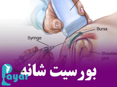 چه عواملی باعث بورسیت شانه می شوند؟
