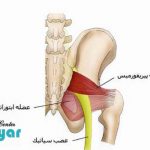 سندروم پیریفورمیس (علت و درمان درد پشت لگن و باسن)