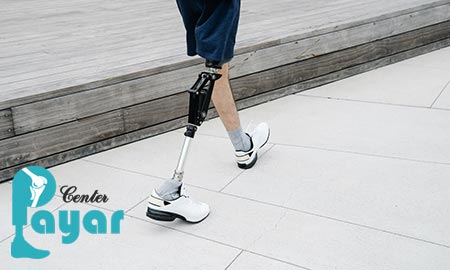 آیا با انواع پروتز اندام تحتانی آشنایی دارید؟