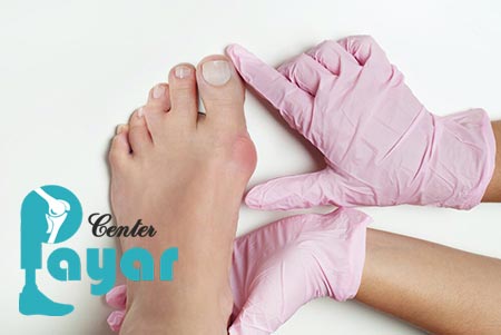 آیا میدانید عوارض عمل فیوژن مچ پا چیست