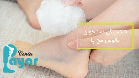 ارتباط شکستگی تالوس پا عوارض عمل فیوژن مچ پا