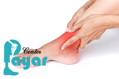 برای کاهش درد بعد از عمل خشک کردن مفصل مچ پا چه باید کرد؟