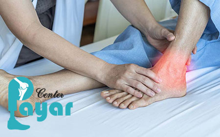 بعد از عمل فیوژن مچ پا چگونه راه برویم؟ 