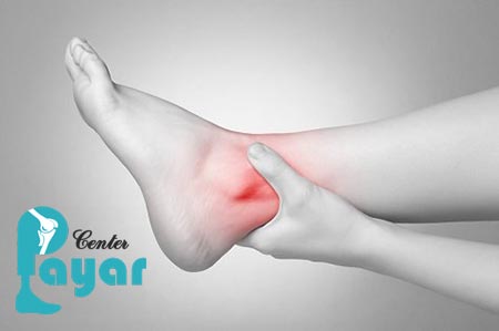 خشک کردن مفصل مچ پا و عوارض این عمل جراحی