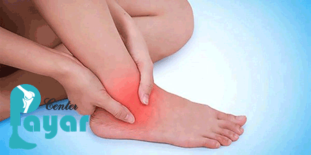 درمان و علائم عوارض عمل فیوژن مچ پا