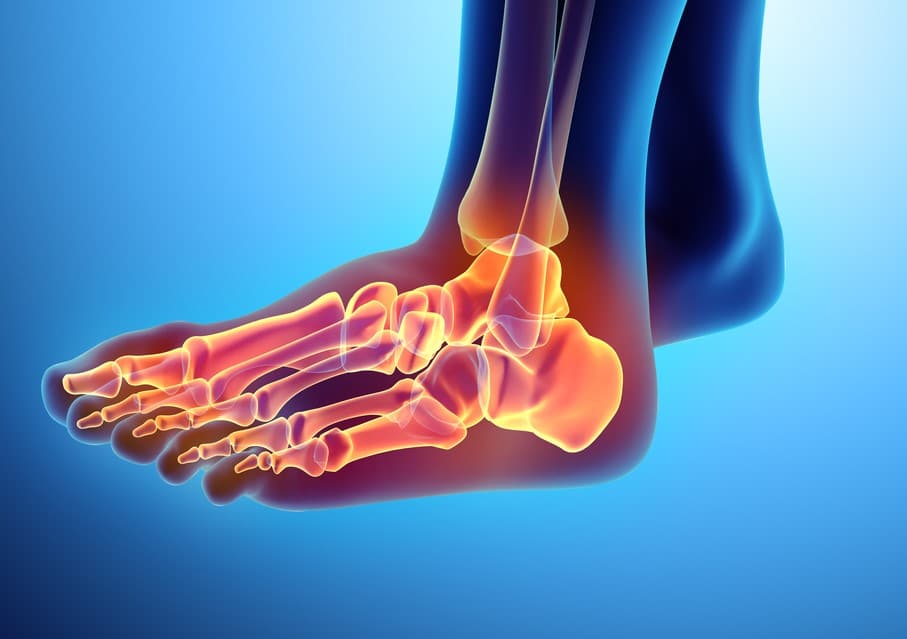 بدترین عوارض خشک کردن مفصل مچ پا
