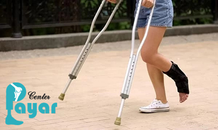نحوه راه رفتن بعد از خشک کردن مفصل مچ پا