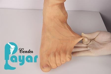 عملکرد پروتز زیبایی مچ پا
