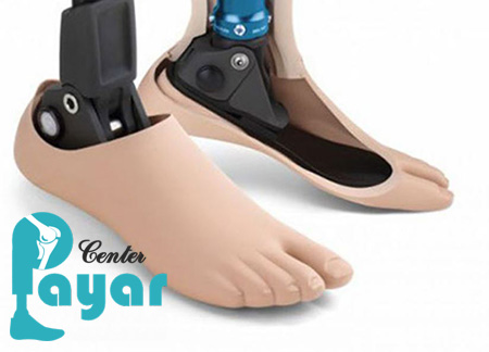 پروتز مچ پا یا پای مصنوعی هوشمند چیست؟ هزینه پروتز مچ پا هوشمند چقدر است؟