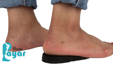 برای ساخت کفش طبی برای کوتاهی پا چه باید کرد؟