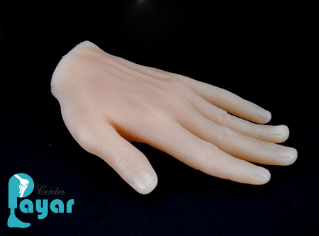 ساخت مچ دست مصنوعی در مرکز فروش دست مصنوعی