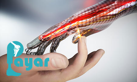 آیا قیمت دست مصنوعی هوشمند در ایران از قیمت دست مصنوعی مکانیکی بالاتر است؟