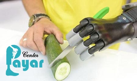 قیمت دست مصنوعی مکانیکی در کلینیک پایار