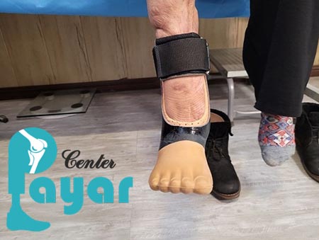 مرکز پروتز قوزک پا در کشور کجاست