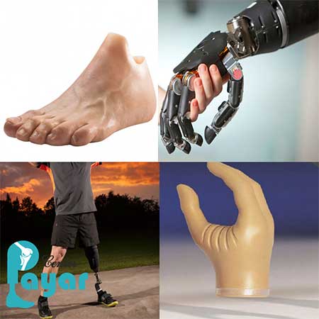 قیمت پروتز اعضای بدن