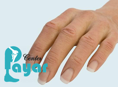 پروتز مصنوعی چیست و بهترین شرکت ساخت اعضای مصنوعی بدن کجاست؟