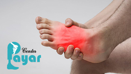 دلیل ورم غضروف مچ پا چیست؟