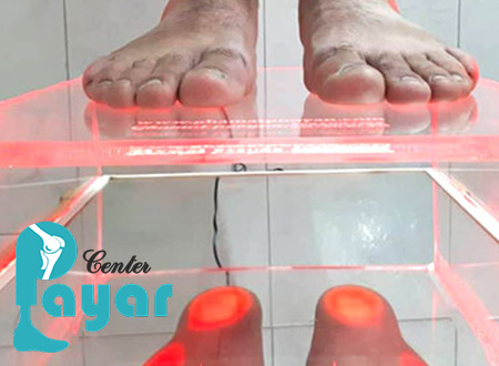 هزینه اسکن کف پا در مشهد بیشتر است یا هزینه اسکن کف پا در تهران؟