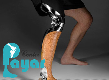 آیا ساخت کفش دیابتی در شیراز یکی از وظایف مراکز ساخت پای مصنوعی در شیراز است؟
