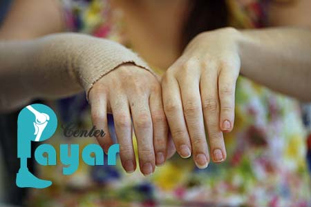 با چند بیمارستان فوق تخصصی پیوند دست در تهران آشنا شوید!؟