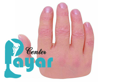 رشد بازسازی انگشتان قطع شده چیست؟