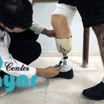 ویژگی های پای مصنوعی پیشرفته⭐معرفی پیشرفته ترین