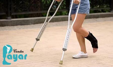 آرترودز یعنی چه؟هر آنچه که می بایست درباره آرترودز باید بدانید