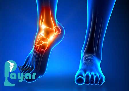 آرترودز یعنی چه؟ هر آنچه درباره آرترودز باید بدانید