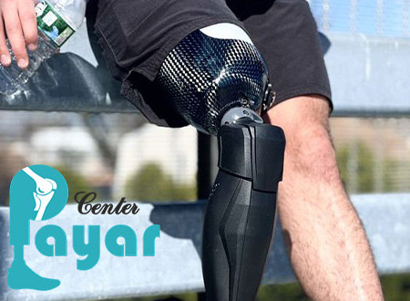 راه رفتن با پروتز بالای زانو به کمک عصا چگونه است؟