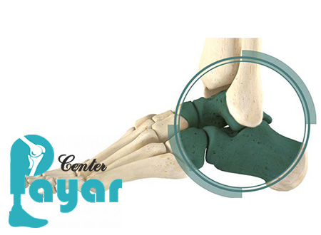 آرترودز یعنی چه و آشنایی با آن