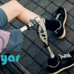 نکات مهم⭐برای راه رفتن با پروتز بالای زانو که باید بدانید؟