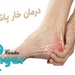 آیا خار پاشنه خطرناک است؟⭐آیا با کفی و کفش طبی درمان می شود؟