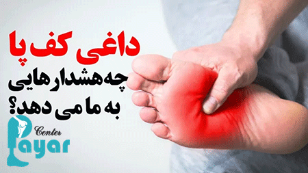 درمان سوزش کف پا با روش های خانگی و تضمینی