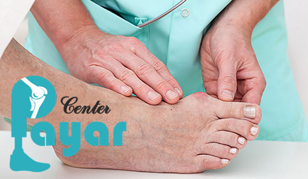 در معتبرترین مراکز ارتوپد فنی تهران چه نکاتی در ساخت پروتز مچ پا رعایت میشود؟