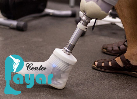 آیا کسی که برای ساخت پروتز مچ پا اقدام می کند، نیاز به لاینر پای مصنوعی دارد؟