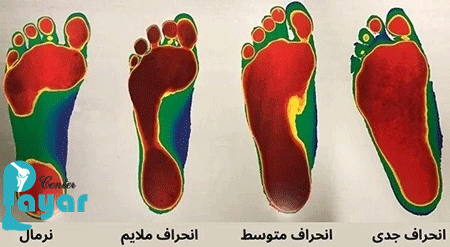 کاربردهای اسکن کف پا چیست