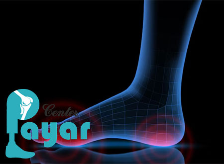 فواید اسکن کف پا چیست؟