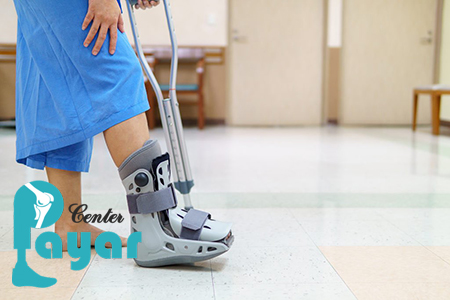 بهترین جایگزین برای قطع پا از مچ