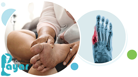 در مورد علائم قطع پای دیابتی چه میدانید؟
