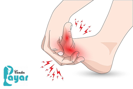 علائم قطع پای دیابتی چیست؟