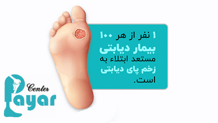 هزینه قطع پای دیابتی و عوارض بعد از قطع پای دیابتی