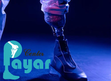 از معایب ساخت پروتز مچ پا چه می دانید؟