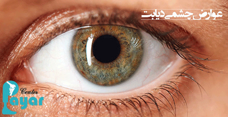 در مورد علائم چشم دیابتی چه میدانید؟