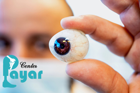 پروتز چشم اوربیتال، بهترین چشم مصنوعی