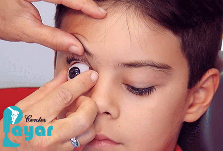 چه کسانی می بایست برای ساخت و نصب پروتز چشم اوکولار اقدام کنند؟