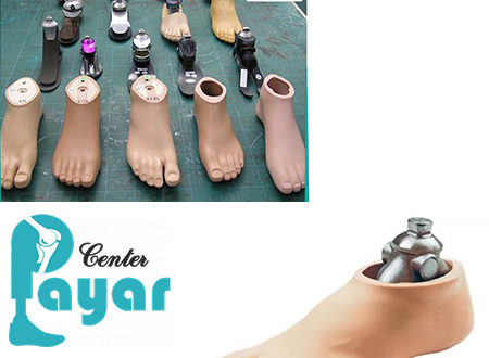 آیا قطع عضو از مچ پا و اقدام برای ساخت پروتز مچ پا باعث کم شدن عمر می شود؟