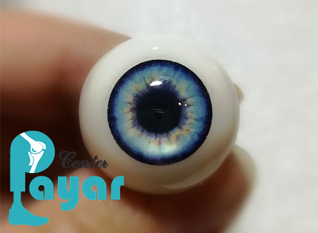بهترین مرکز ساخت پروتز چشم در شیراز یا تهران؟ کدام بهتر است؟